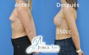 462_LAT