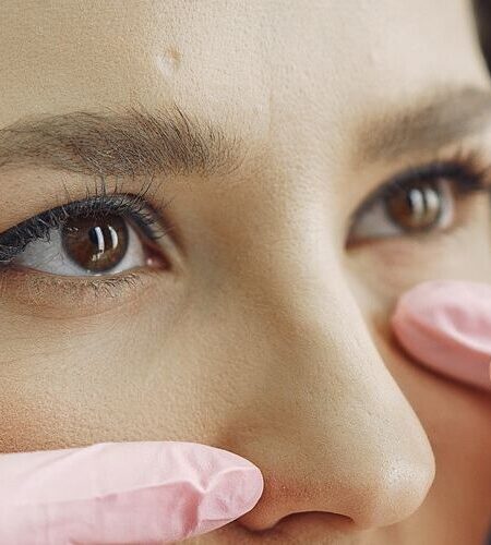 rinoplastia rinoplastia