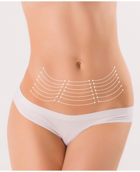 Abdominoplastia en Madrid con el Dr. Jorge Aso