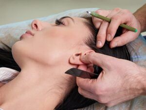 otoplastia en madrid