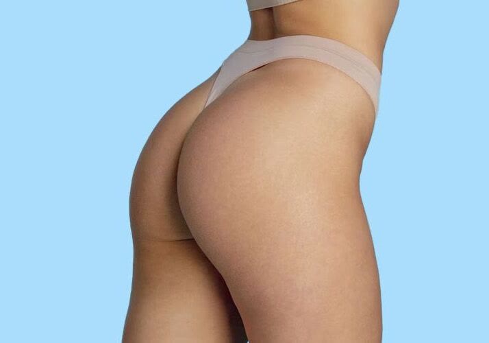 Perfil posterior que ilustra el contorno de cintura, cadera y glúteo tratado mediante lipofilling